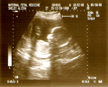 10 Sonogram in New York Neighborhoods