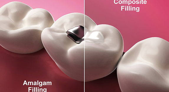 10 Fillings in New York Neighborhoods