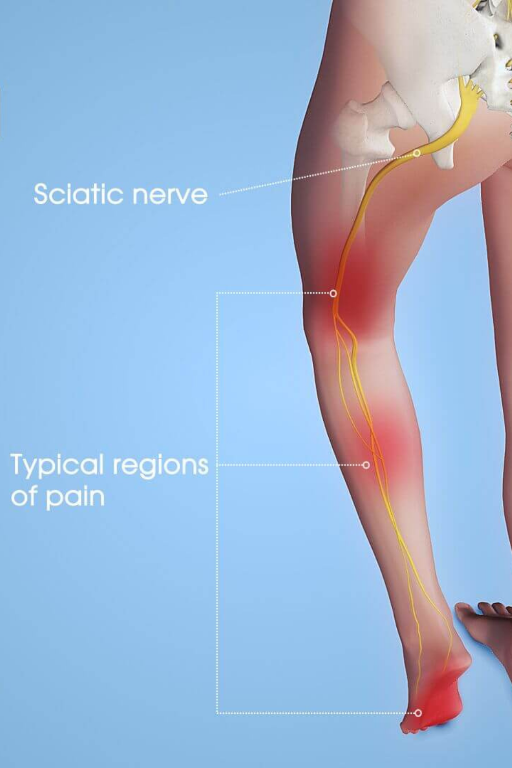 10 Sciatica Massage in New York Neighborhoods