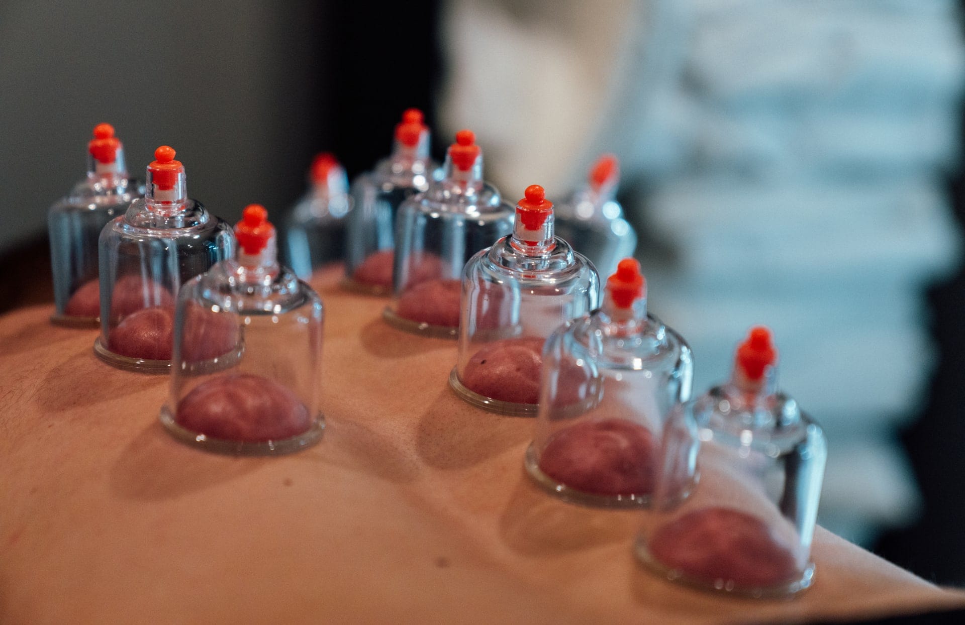 10 Cupping in New York Neighborhoods
