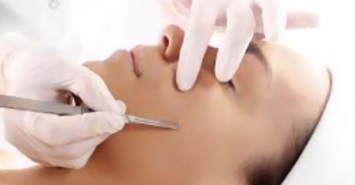 10 Dermaplane in New York Neighborhoods