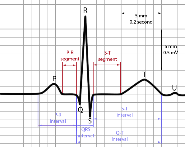10 Ekg in New York Neighborhoods