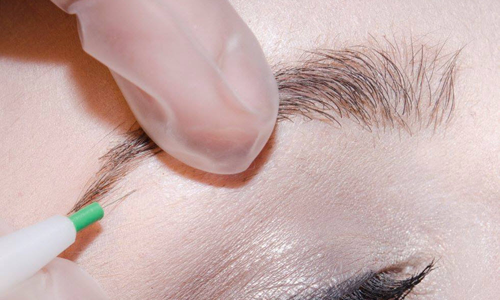 10 Electrolysis Hair Removal in New York Neighborhoods