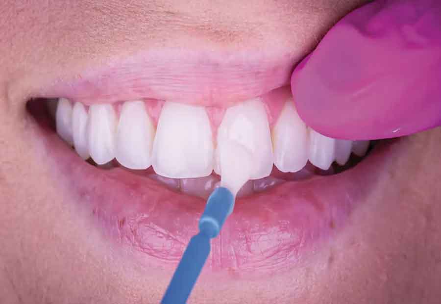 10 Fluoride Treatment in Los Angeles Neighborhoods