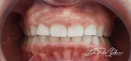 10 Gum Specialist in New York Neighborhoods