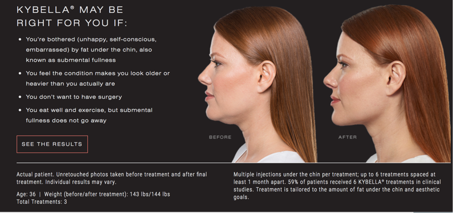 10 Kybella in New York Neighborhoods