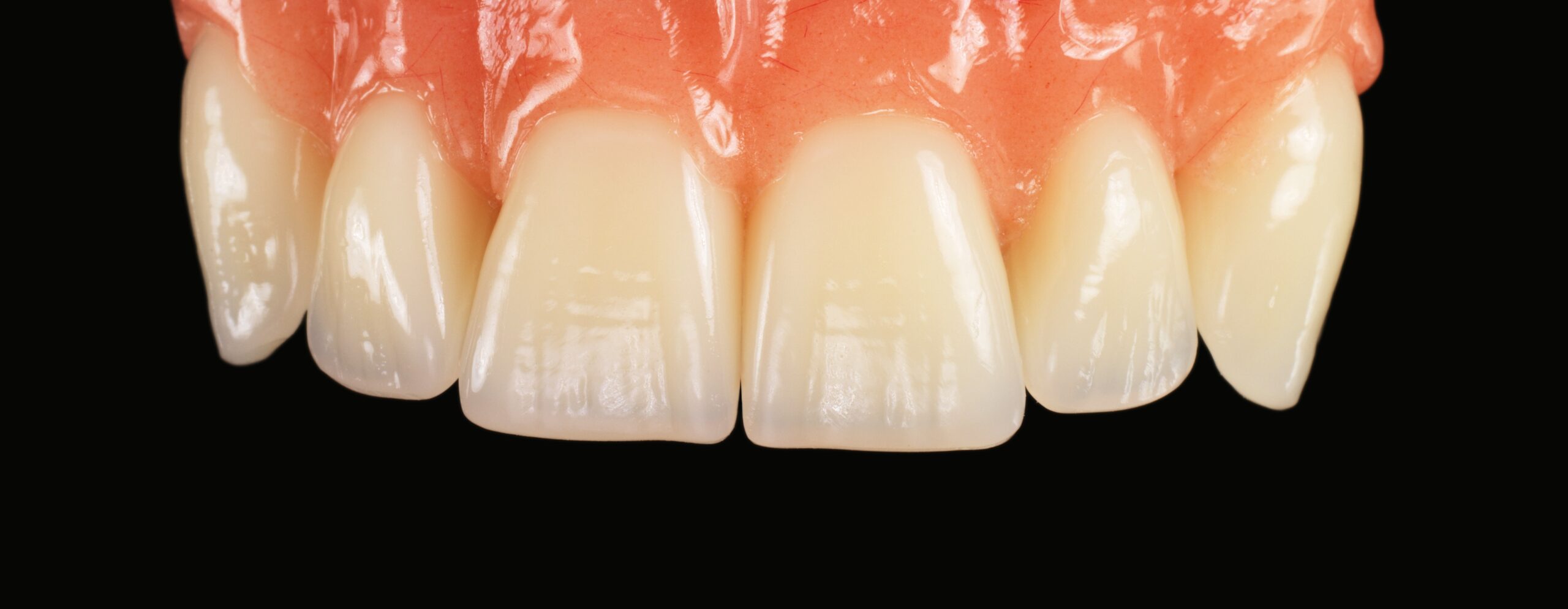 10 Sameday Dentures in New York Neighborhoods