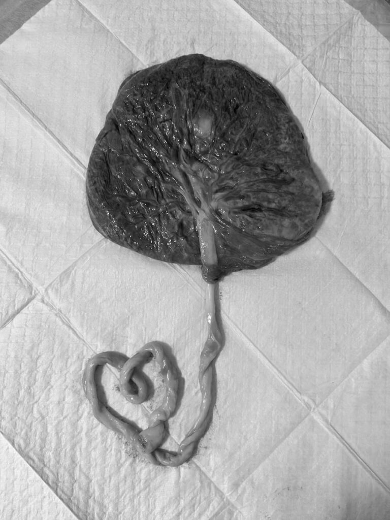 10 Placenta Encapsulation in New York Neighborhoods