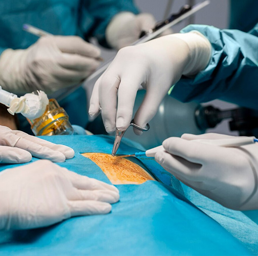 10 Cyst Removal in New York Neighborhoods