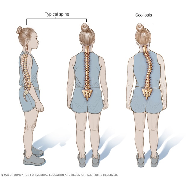 10 Scoliosis Specialist in New York Neighborhoods