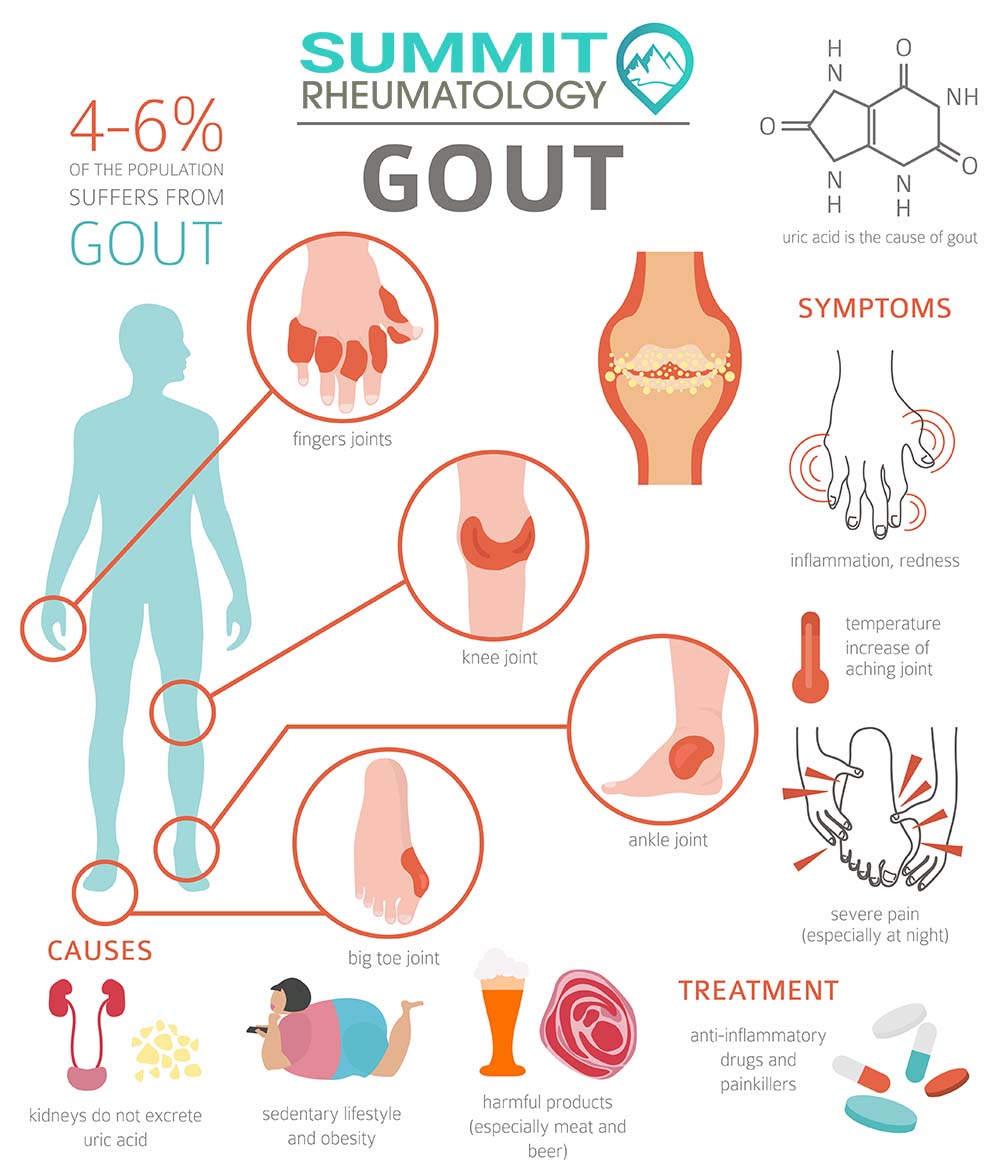 10 Gout Doctor Specialist in New York Neighborhoods