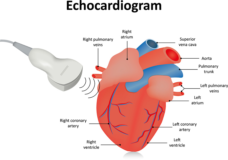 10 Echocardiogram in New York Neighborhoods