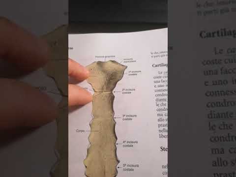 10 Sternos in New York Neighborhoods