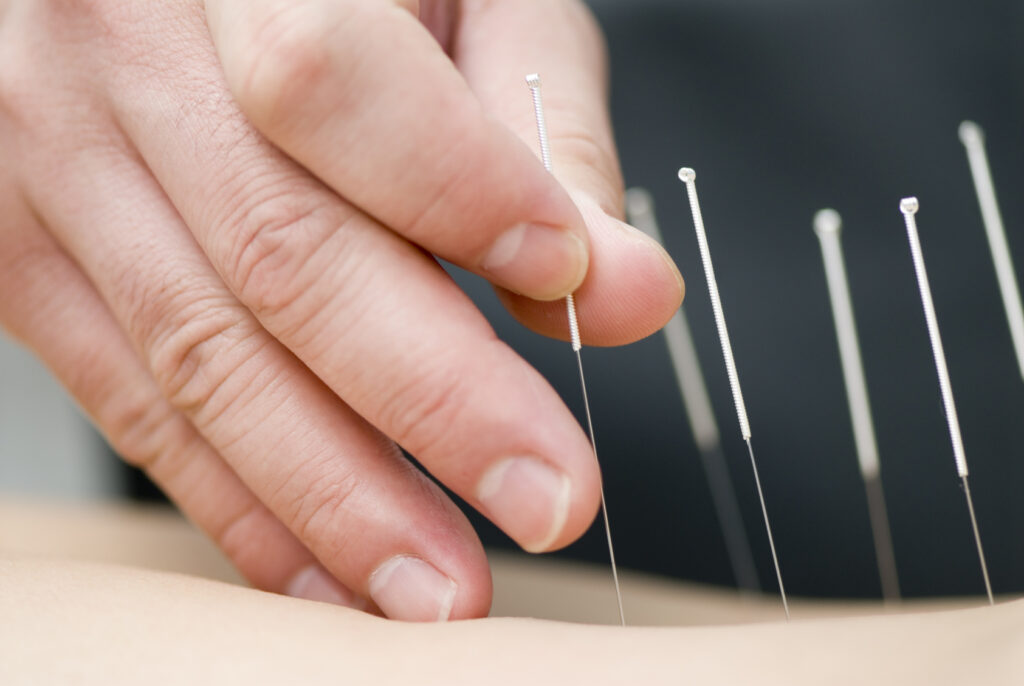 10 Acupuncture Clinic in New York Neighborhoods