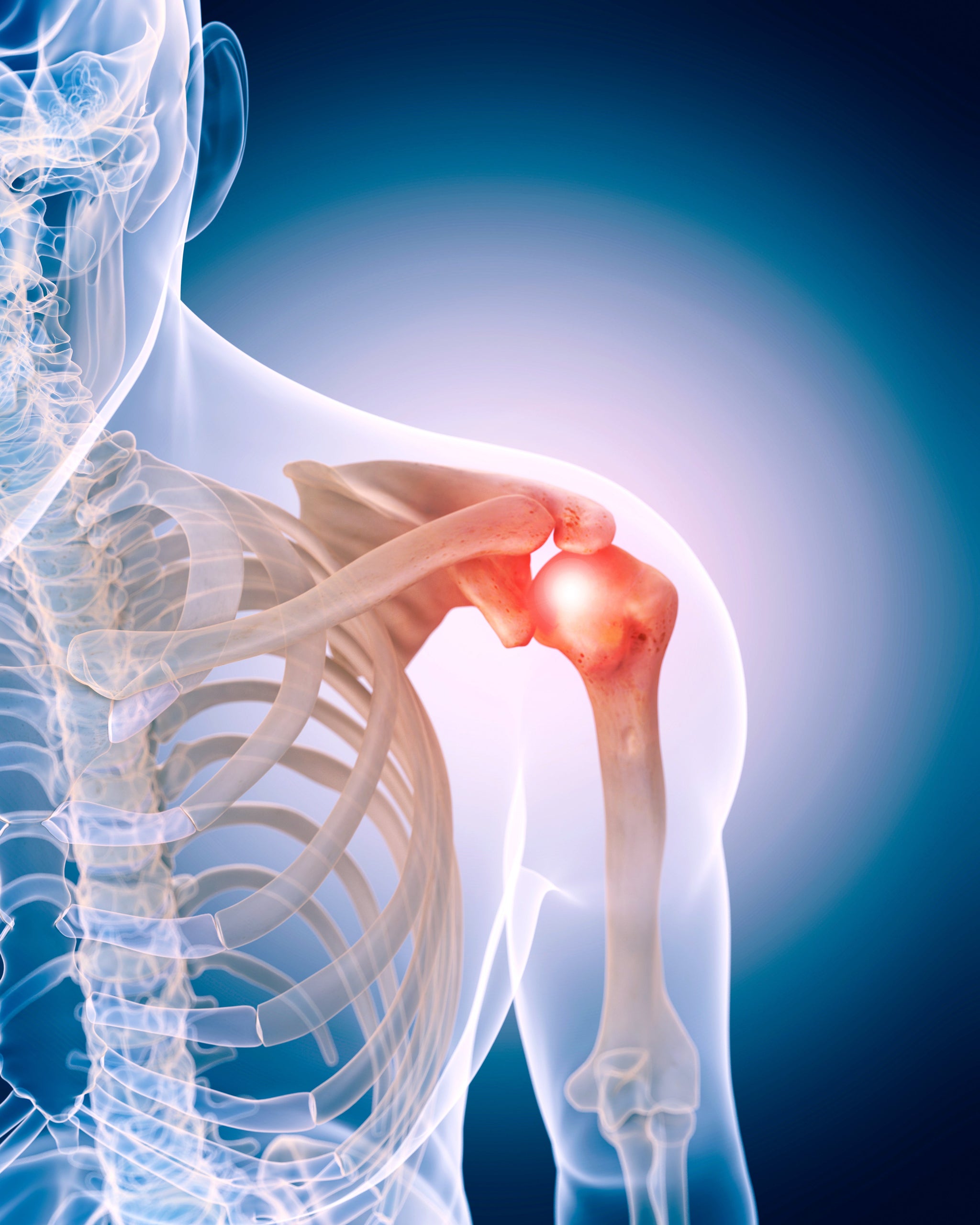 10 Shoulder Specialist in New York Neighborhoods