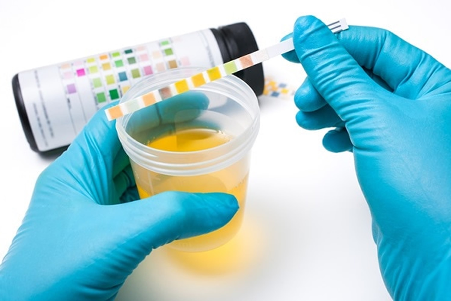 10 Urinalysis in New York Neighborhoods