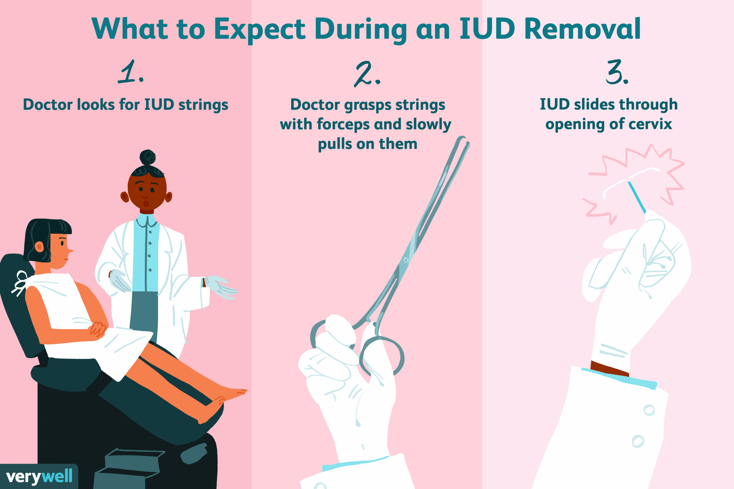 10 Iud Removal in New York Neighborhoods